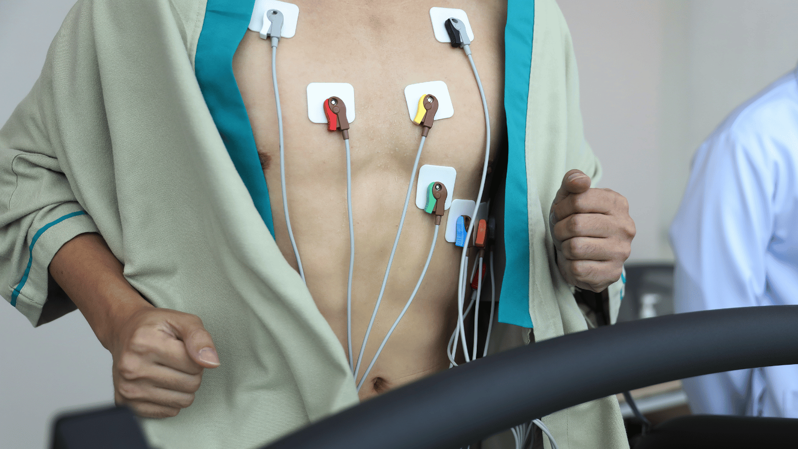 Qual è l’esame per diagnosticare l’aritmia cardiaca?