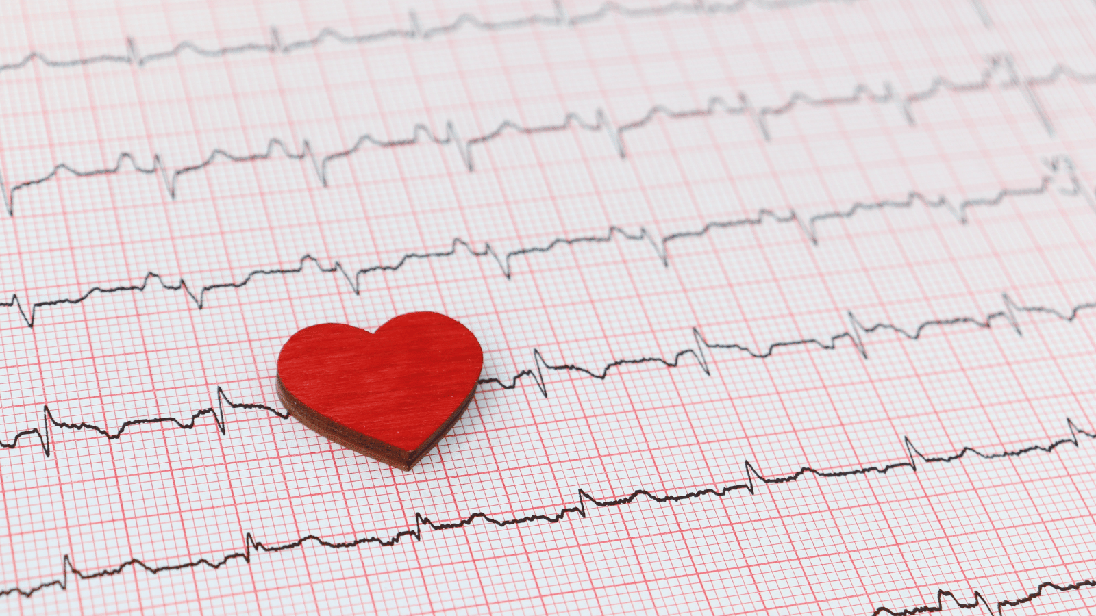 Qual è la causa più comune di cardiopatia ischemica?