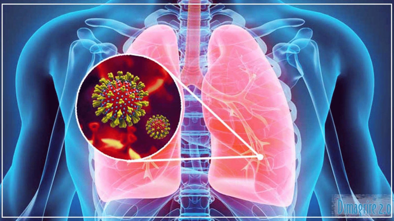 Cosa provoca l’insufficienza respiratoria?