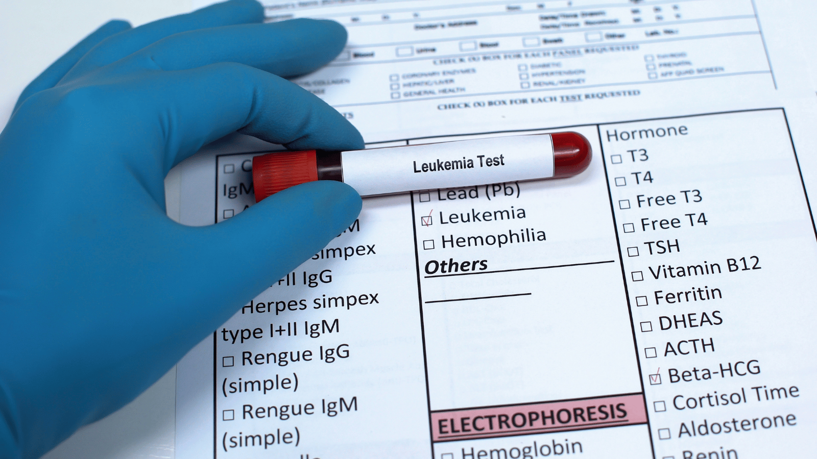 Leucemia