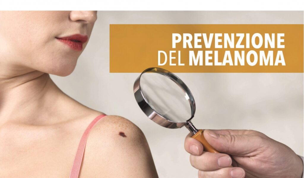 Prevenzione del Melanoma